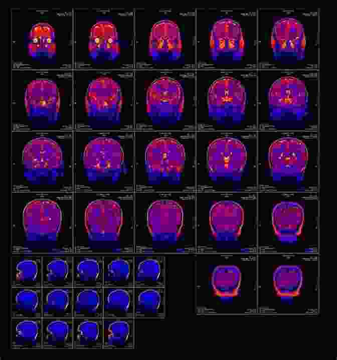 A Functional Magnetic Resonance Imaging (fMRI) Scan Of The Human Brain, Revealing Intricate Neural Activity Patterns. The Future Of The Brain: The Promise And Perils Of Tomorrow S Neuroscience