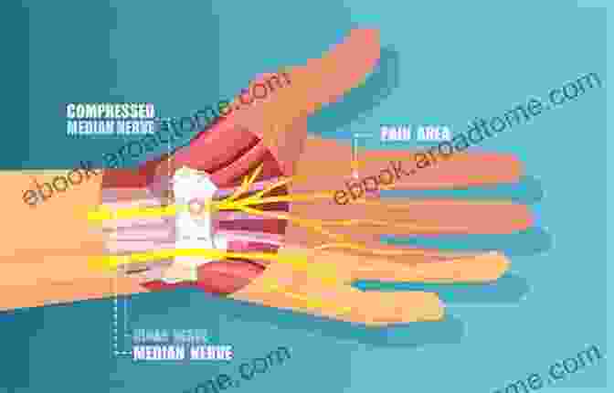 A Woman Holding Her Wrist In Pain, With The Words 'Carpal Tunnel Syndrome' Written On Her Hand Treat Your Own Carpal Tunnel Syndrome At Home