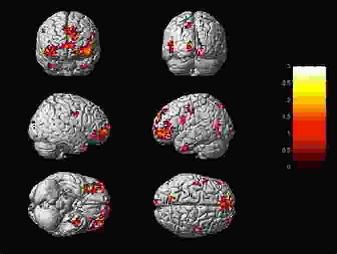 Brain Scan Showing Activity Patterns Related To Consciousness A Blueprint For The Hard Problem Of Consciousness