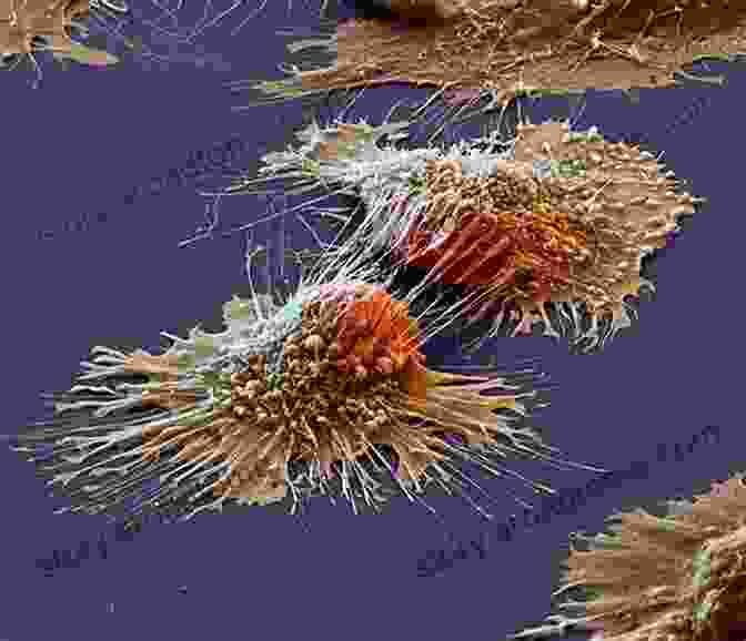 Microscopic Image Of Cancer Cells Cancer Clinical Trials: A Critical Appraisal (Recent Results In Cancer Research 111)