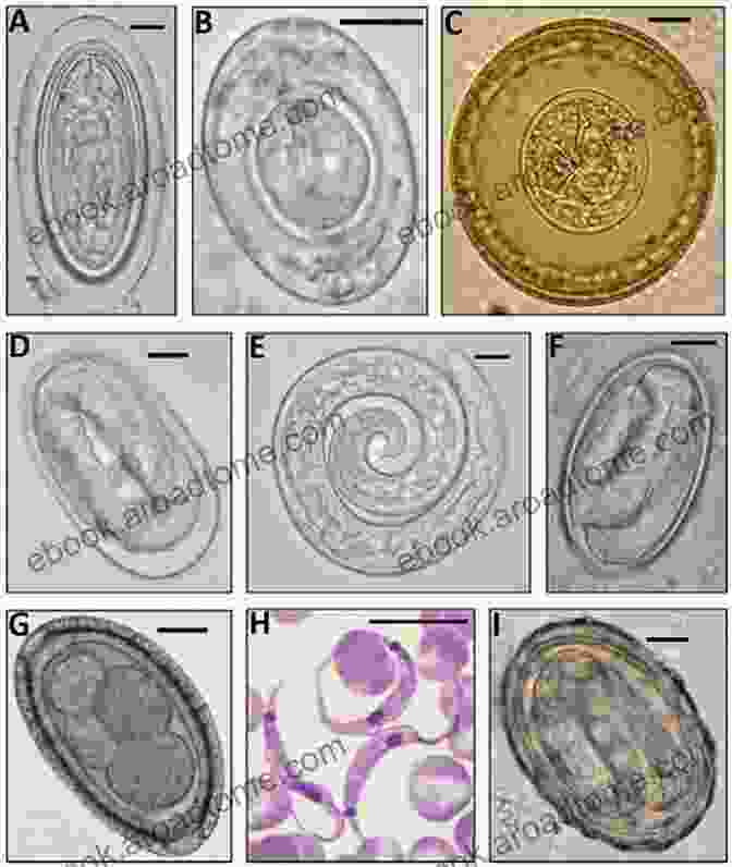 Microscopic Image Of Diverse Parasites, Including Protozoa, Helminths, And Ectoparasites Parasitism And Host Behaviour