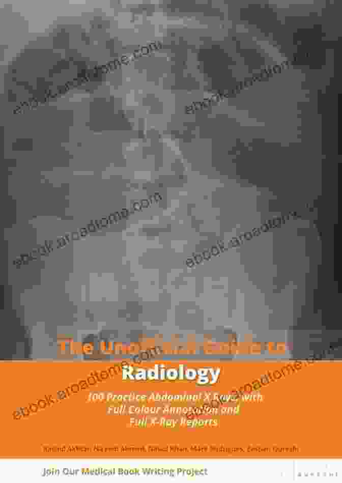 Sample Abdominal Ray Unofficial Guide To Radiology: 100 Practice Abdominal X Rays