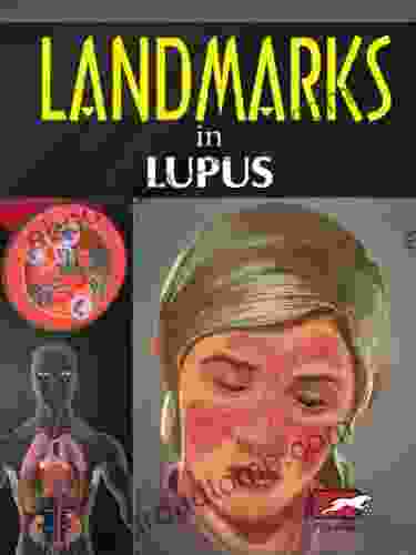 Landmarks in Lupus