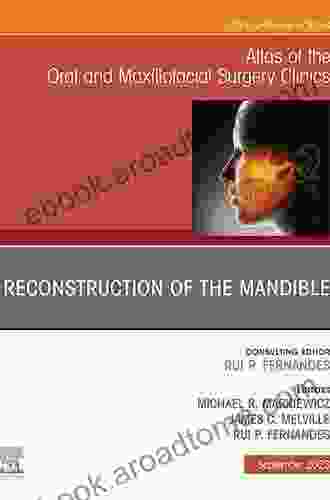 Management Of The Cleft Patient An Issue Of Oral And Maxillofacial Surgery Clinics Of North America (The Clinics: Surgery 28)