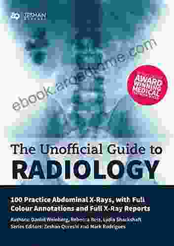 Unofficial Guide To Radiology: 100 Practice Abdominal X Rays