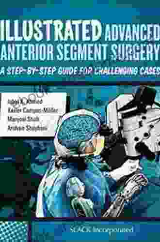 Illustrated Advanced Anterior Segment Surgery: A Step by Step Guide for Challenging Cases