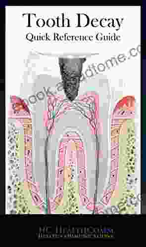 Tooth Decay Quick Reference Guide: Full Illustrated